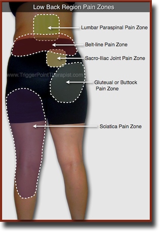 Understanding the Low Back Pain Trigger Points