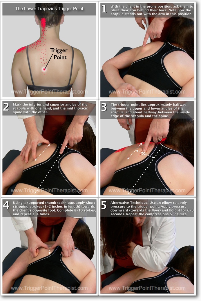 What Are Myofascial Trigger Points? (And 5 Ways To Release Them)