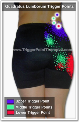 Picture of "Quadtratus Lumborum Pain and Trigger Points"