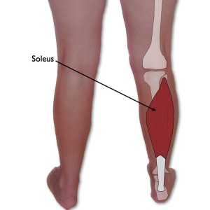 Steroid injection in heel