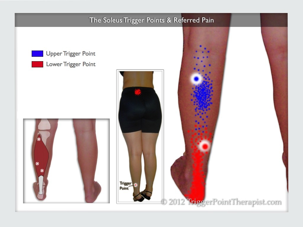 pain between heel and calf