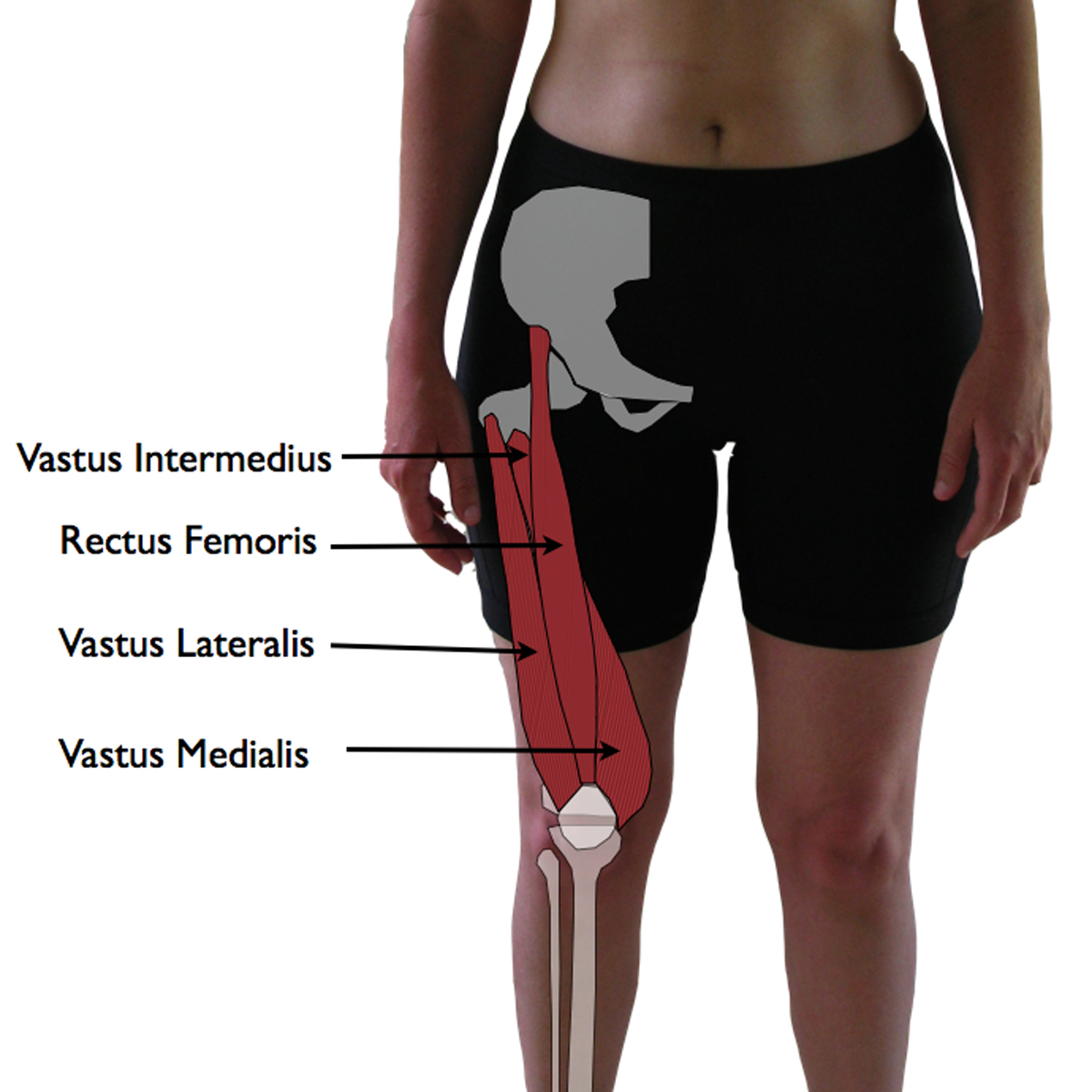 Vastus Lateralis Trigger Points The Knee Pain Trigger Points for cycling quadriceps tendonitis regarding Motivate