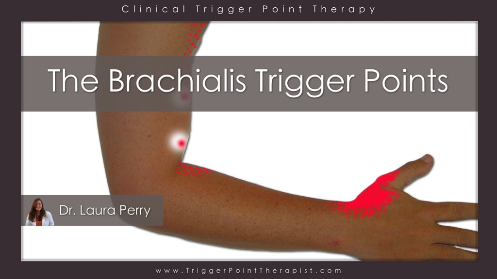 brachialis_trigger_points