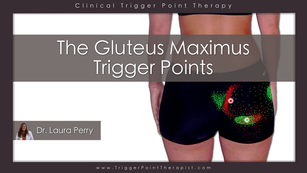 Gluteus Maximus Trigger Points Video