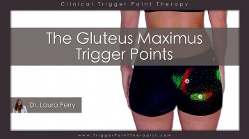 The Gluteus Maximus Trigger Points: A Real Pain in the Rear End