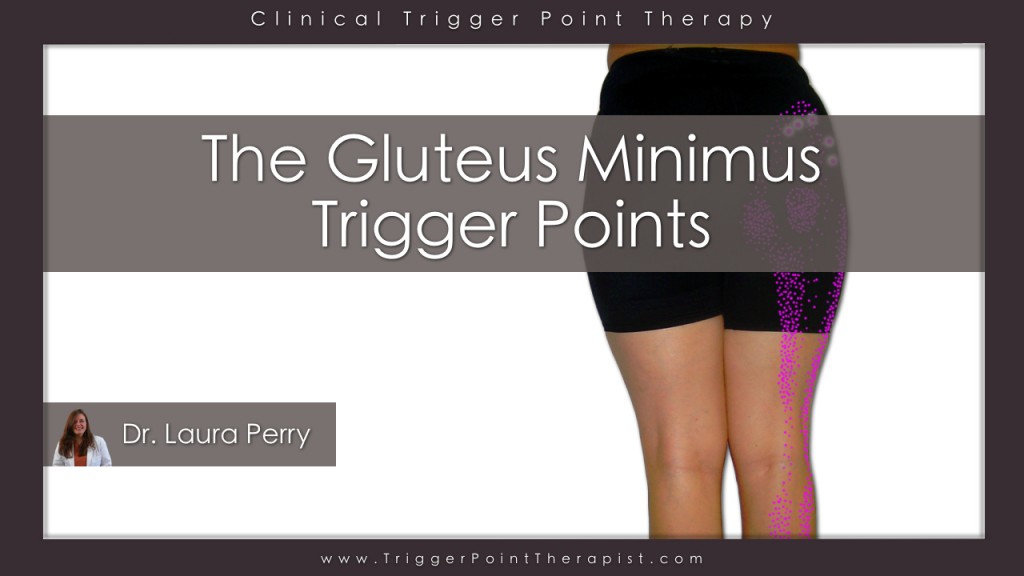 Gluteus Minimus Trigger Points Video