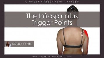 Infraspinatus Trigger Points: The Magicians of Shoulder Pain