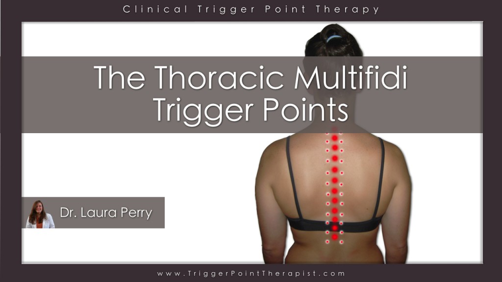 Thoracic Multifidus Trigger Point Video