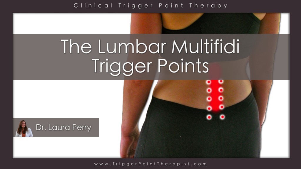  Lumbar Multifidus Trigger Points Video