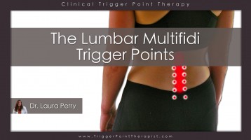 Multifidus Trigger Points: The Chiropractor’s Nemesis
