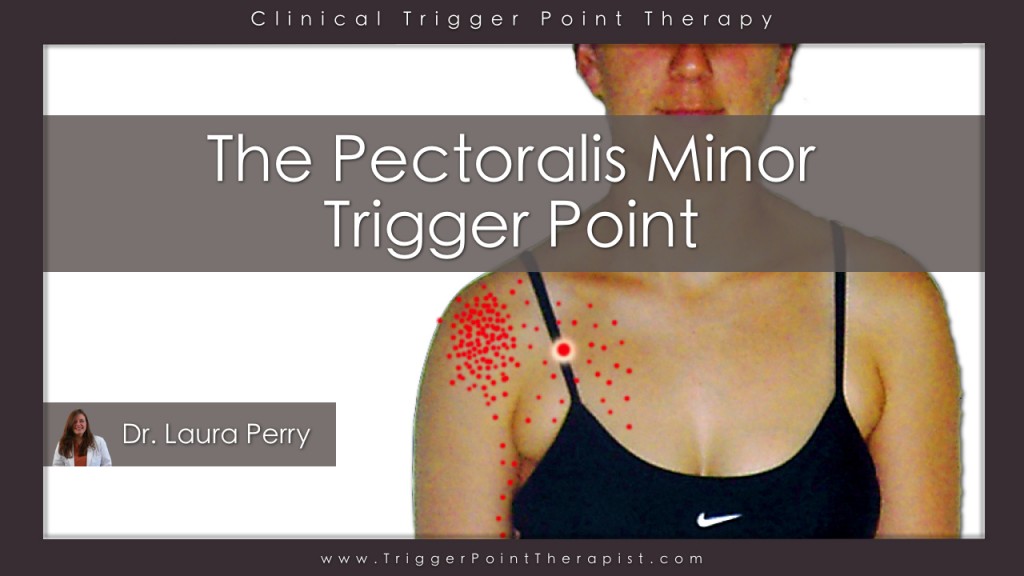 Pectoralis Minor Trigger Point: The Annoying Little Brother