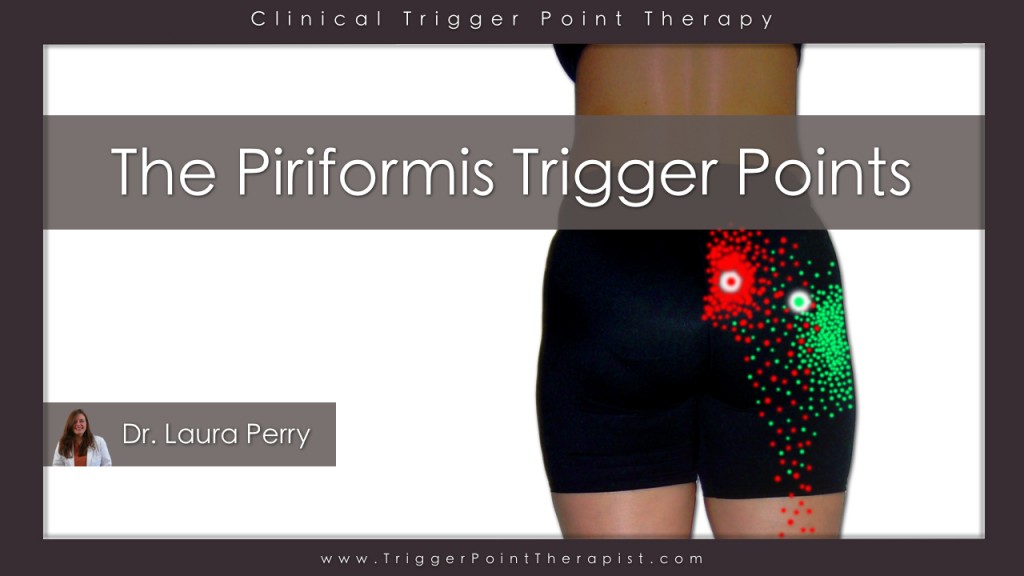 Piriformis Trigger Points Video