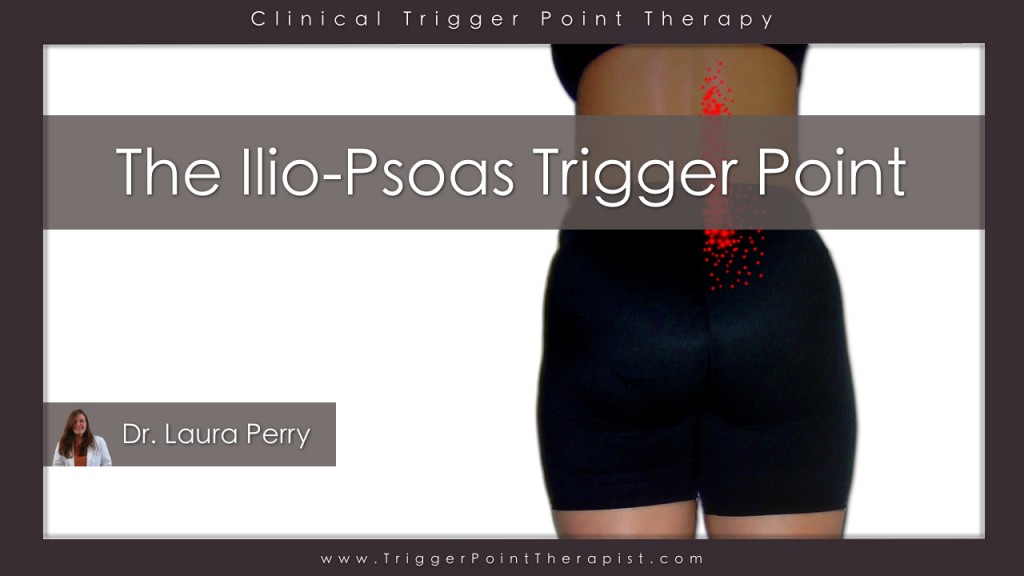 Psoas Trigger Point Video