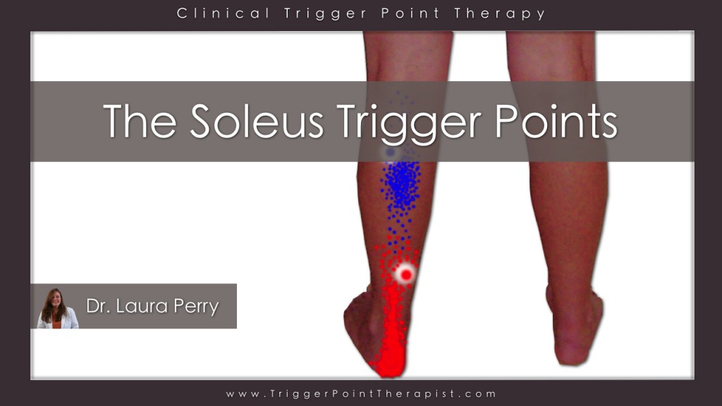 Soleus Trigger Points