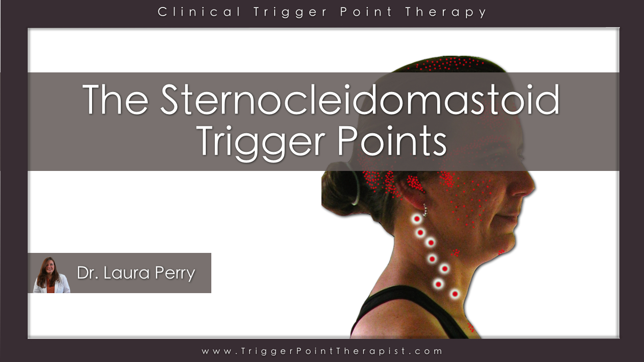 Sternocleidomastoid Trigger Points Master Of The Migraine