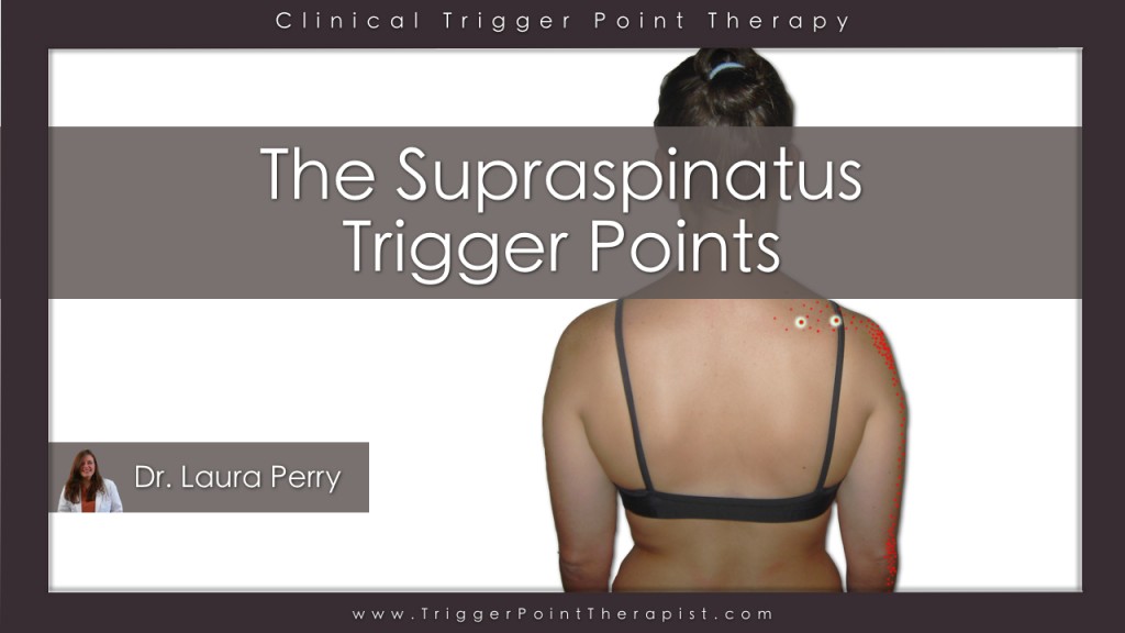 Supraspinatus Trigger Points Video