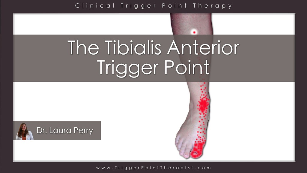 Tibialis Anterior Trigger Point