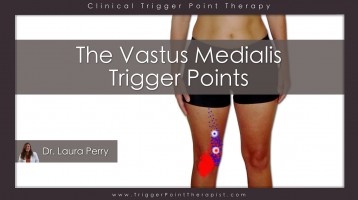 Vastus Medialis Trigger Points: The Knee Pain Trigger Points – Part 3