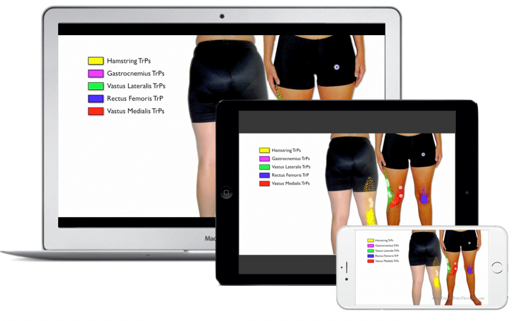 Image for Trigger Point Therapy for Knee Pain Video