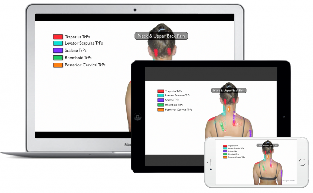 Image for Trigger Point Therapy for Neck Pain & Headaches Video