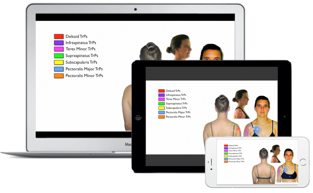 Image for Trigger Point Therapy for Shoulder Pain Video