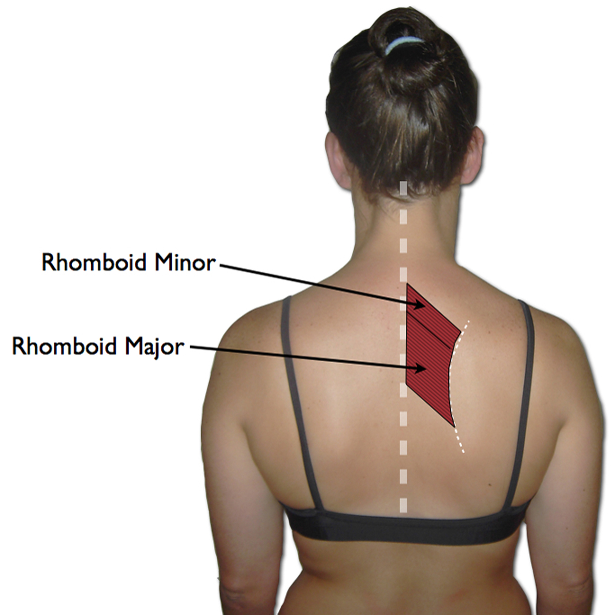List 98+ Images what area of the body are the rhomboid muscles located Stunning