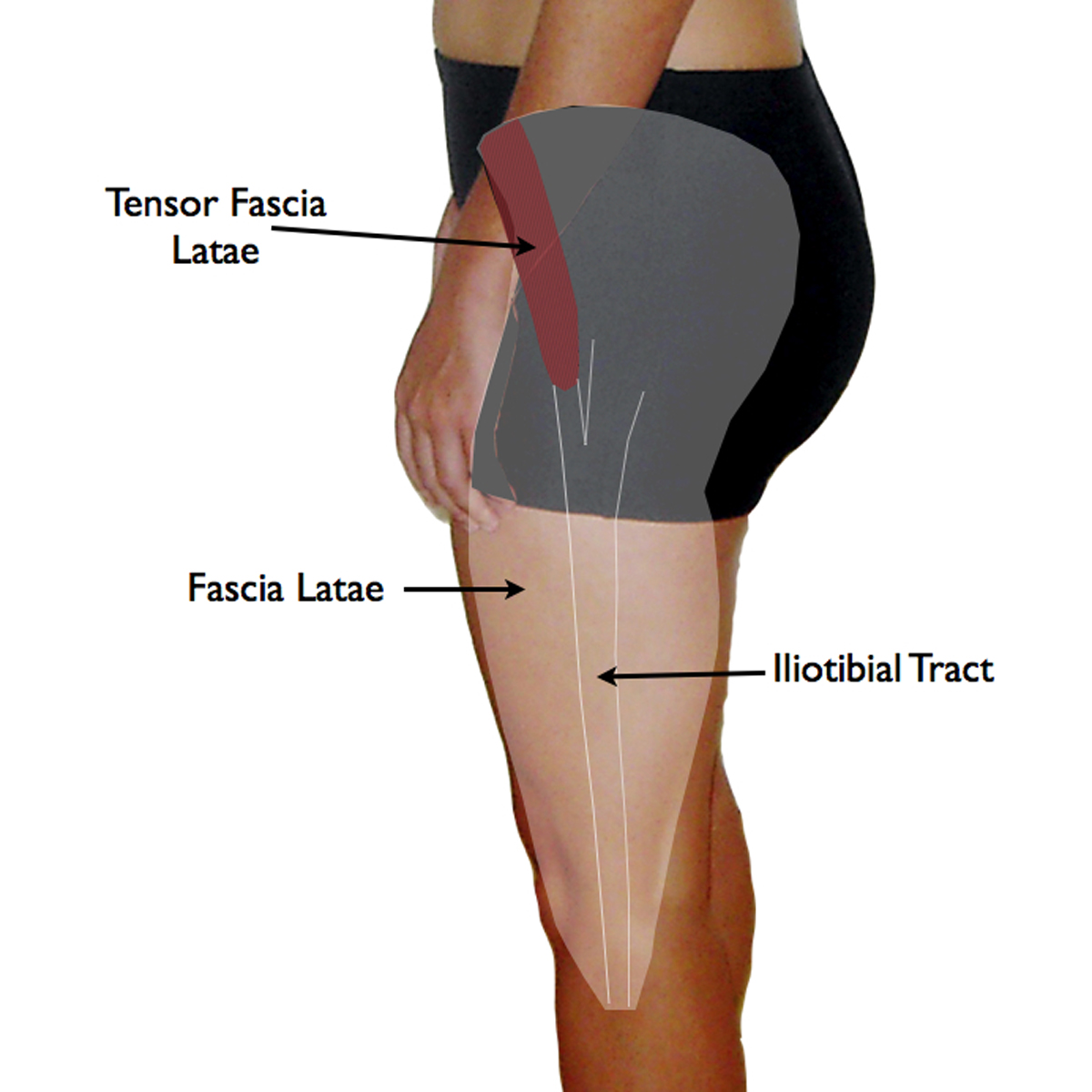 Tensor Fascia Lata Trigger Point in IT Band and Hip Pain Complaints | TriggerPointTherapist.com