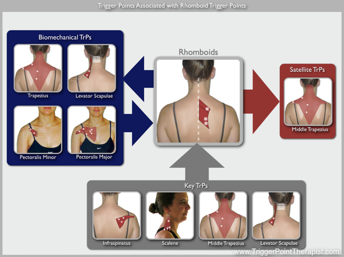 rhomboid_assoctiated_trigger_points