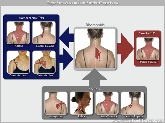 Shoulder muscle knots or trigger pointsBeware Its A Trap